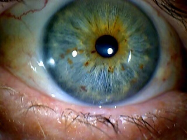 Iridology Eye Color Change Brown Eyes? Insights from MAIKONG CO.LTD