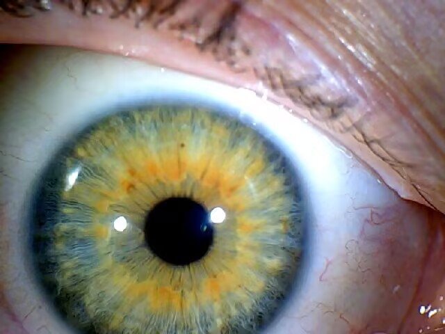 Iridology Eye Color Change Brown Eyes