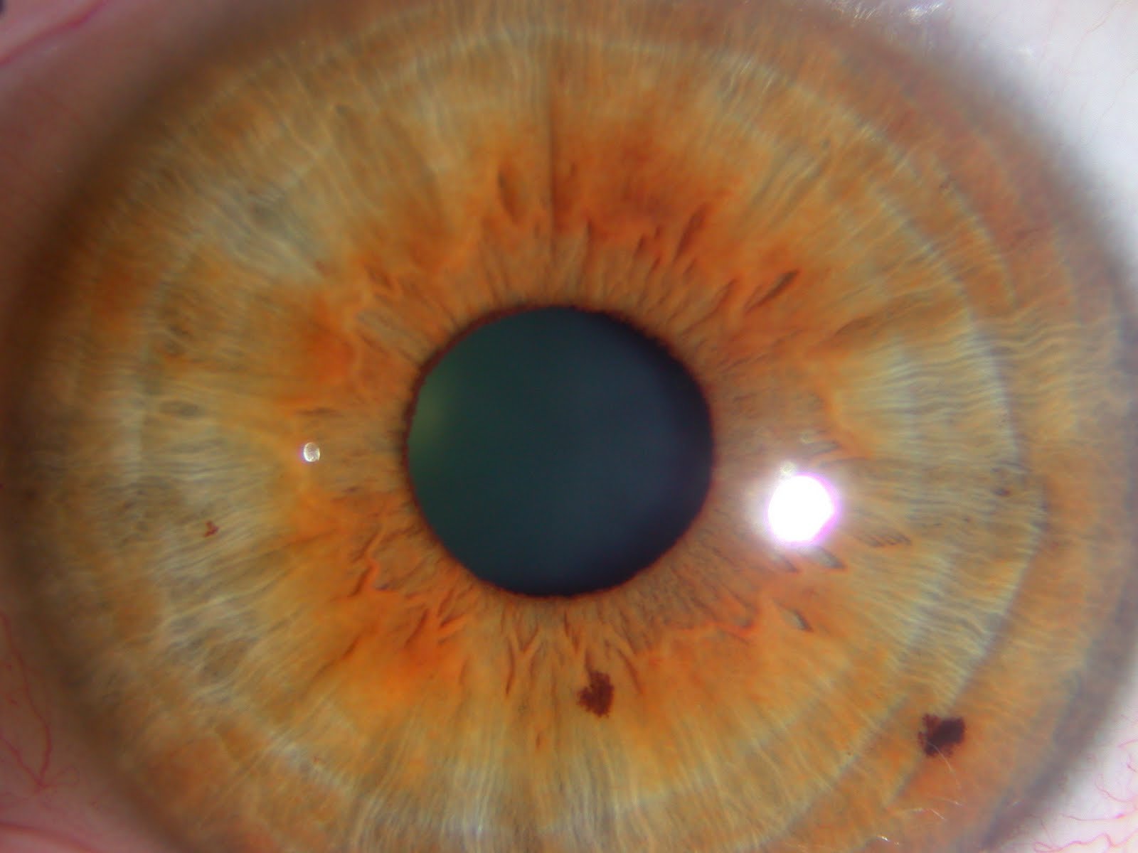 Iridology Eye Color Change Brown Eyes