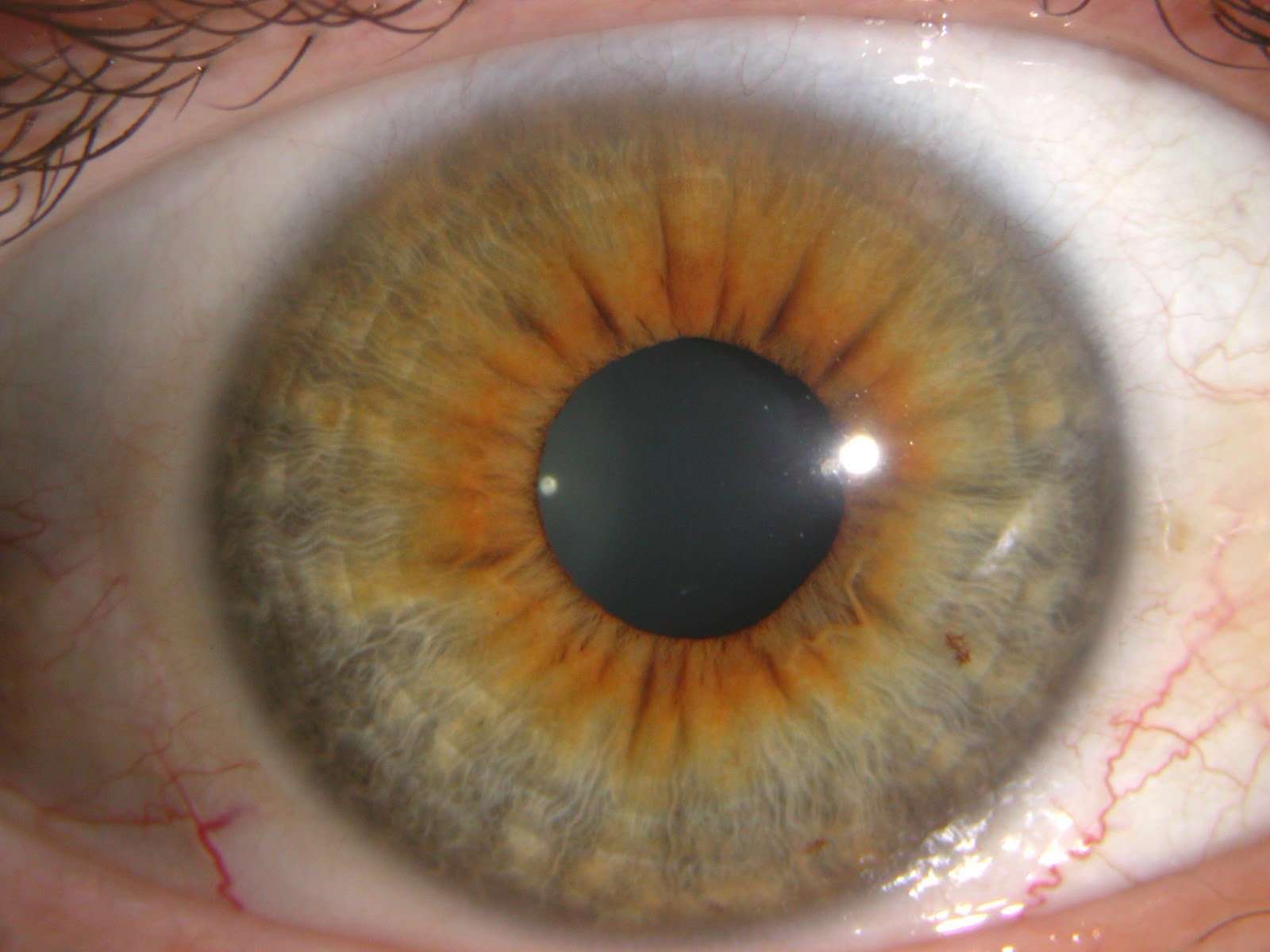 Iridology Eye Color Change Brown Eyes