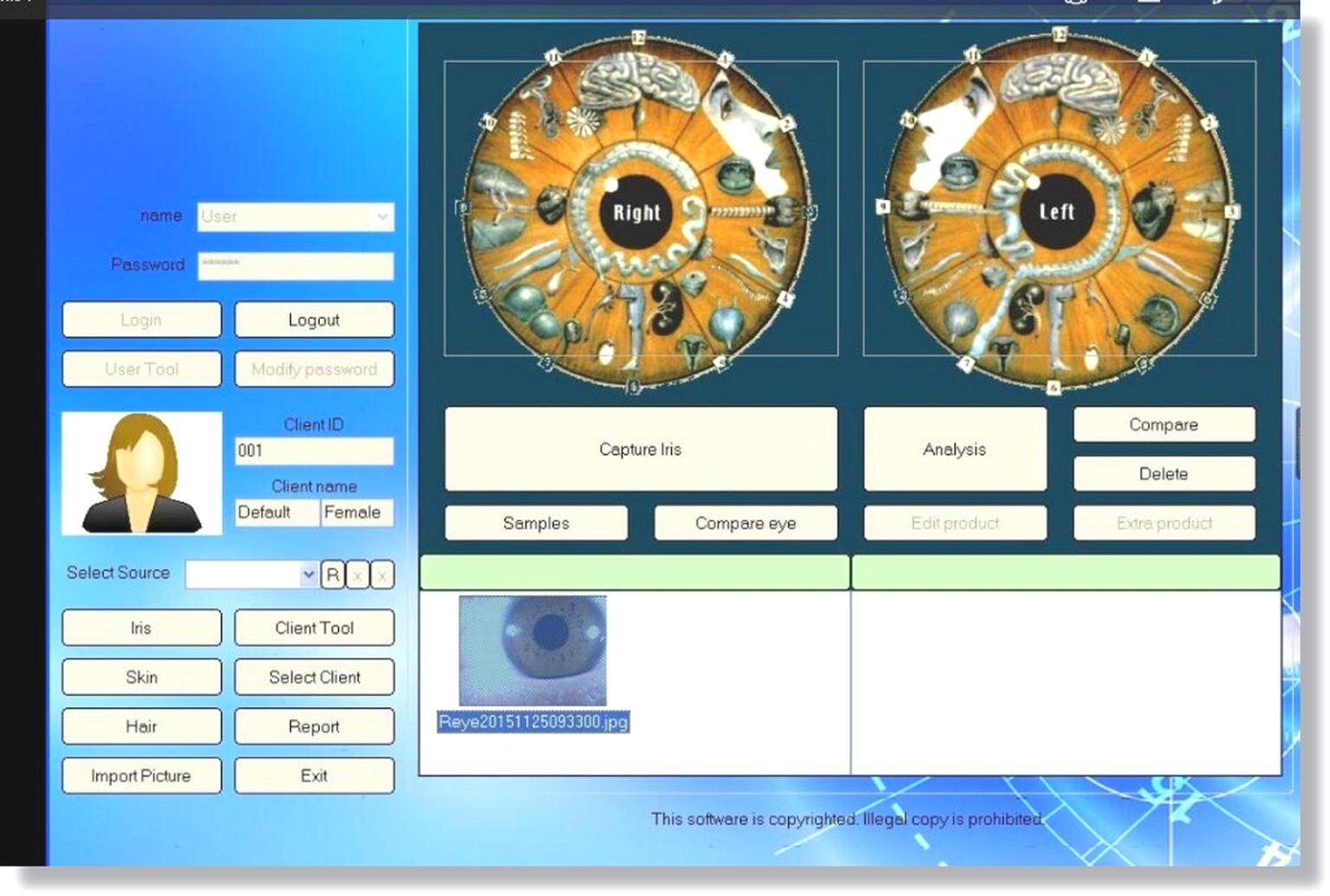 MAIKONG Digital Iriscope Analyzer