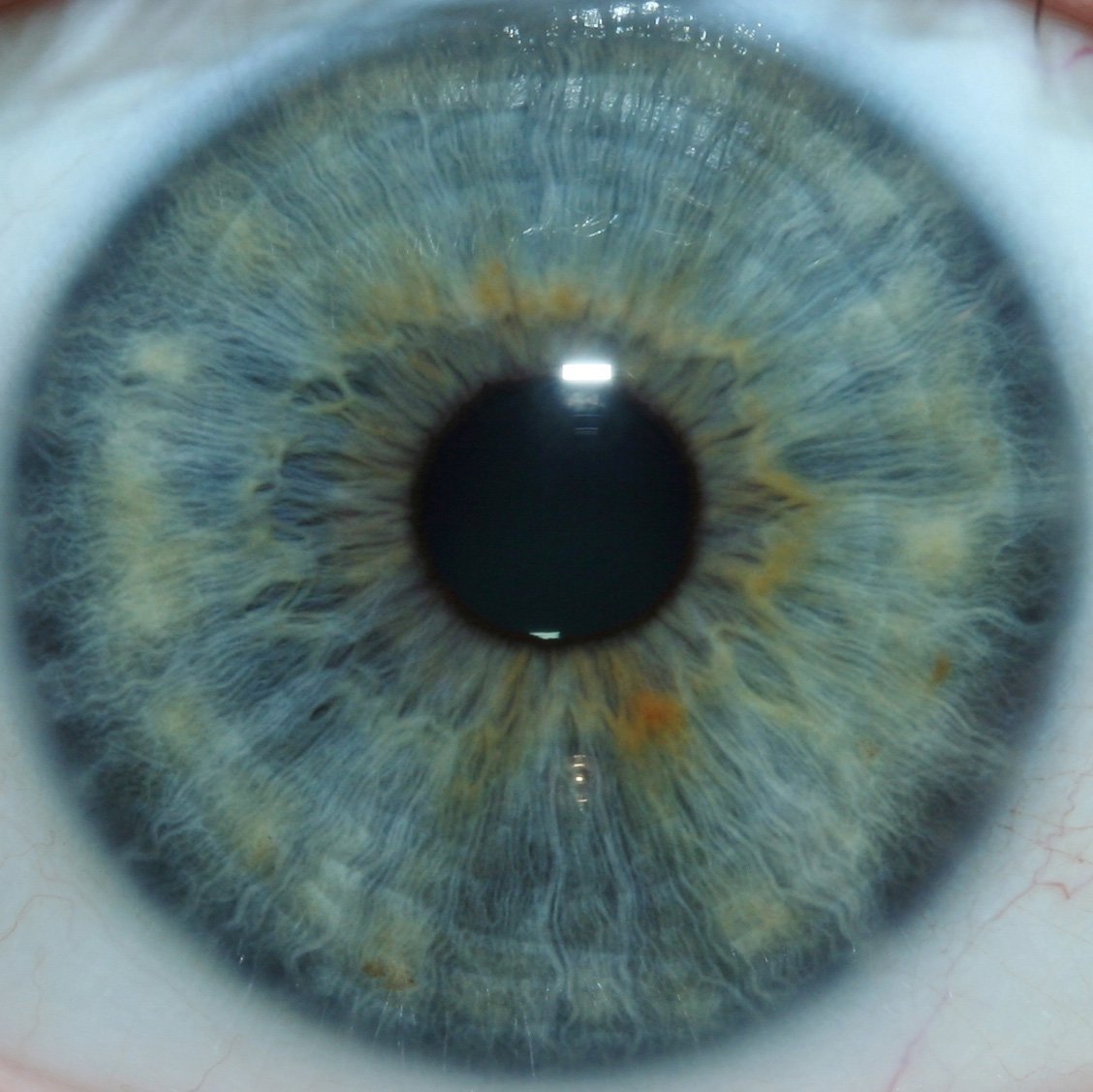 Iriscope iridology camera MK-12 — 009-1.jpg