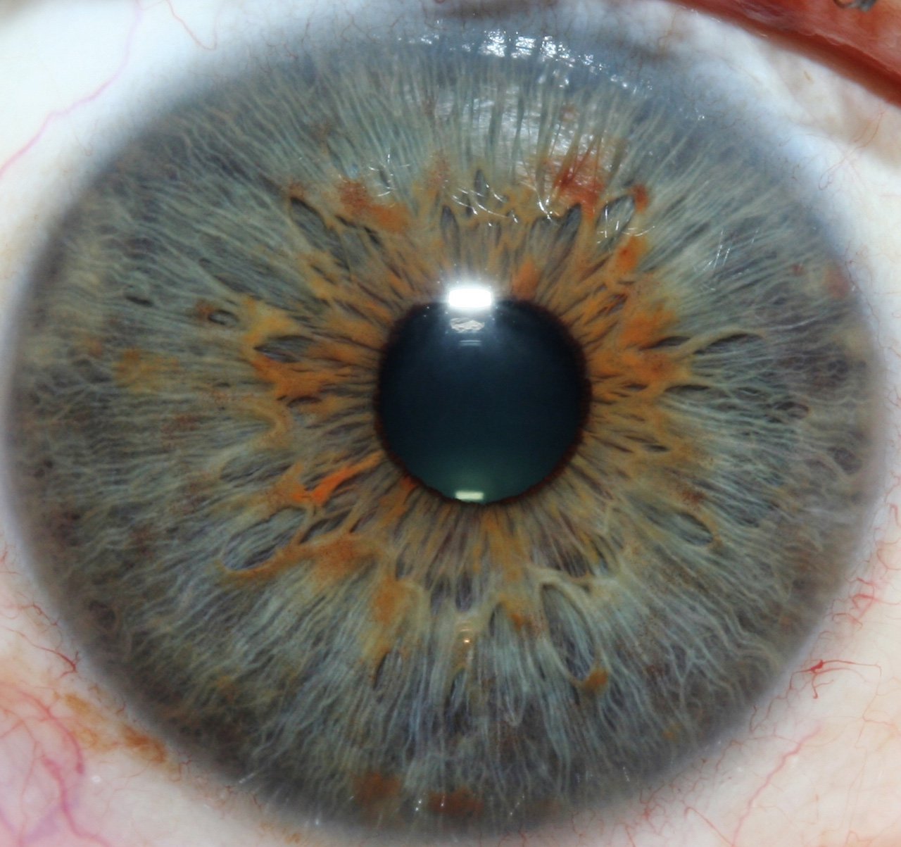 Iriscope iridology camera MK-12 — 010-1.jpg