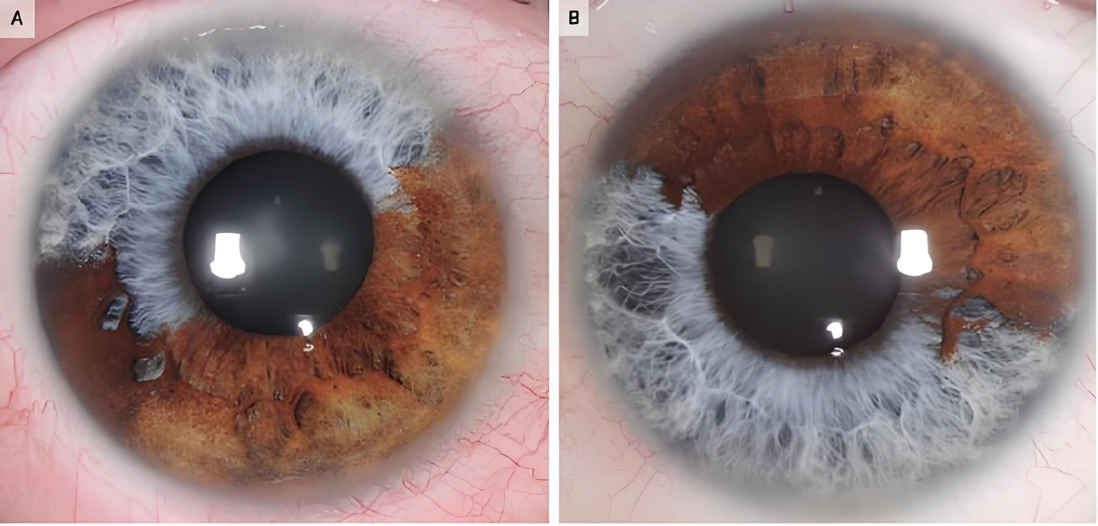 Iriscope iridology camera MK-12 — Iridología (1).jpg