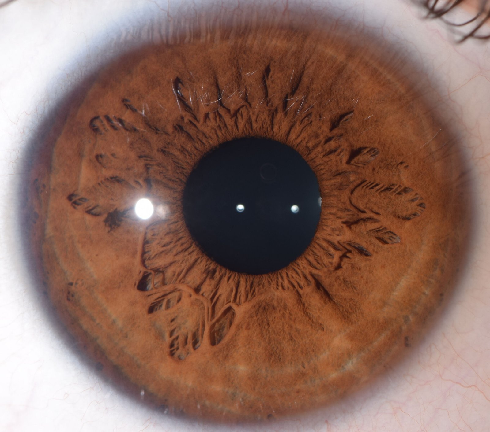 A4 Iridology Chart Transparency: what UK importers need to know before you buy — Iridología (1).jpg