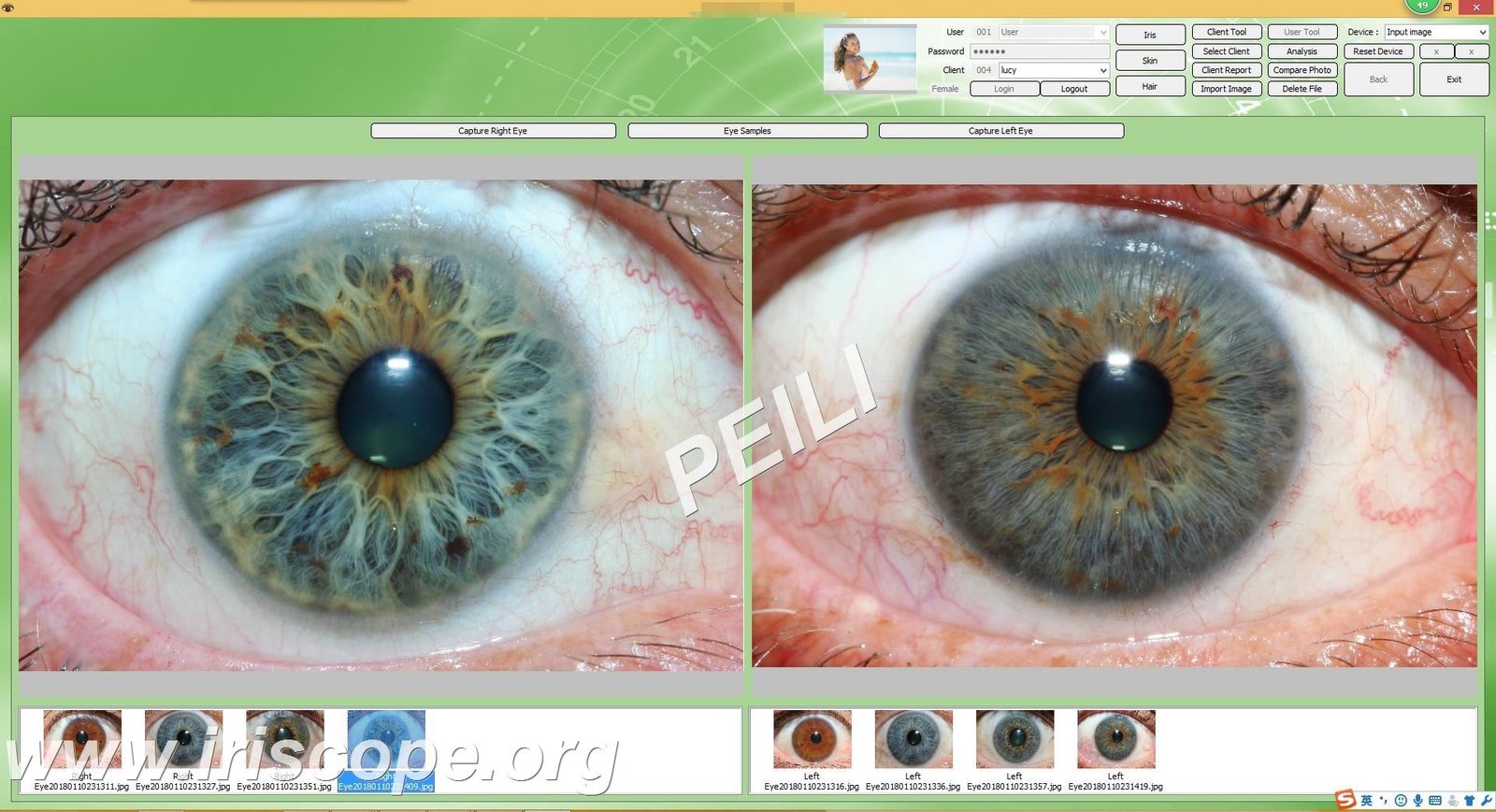 What reflexologists should know when searching for an iriscope in the UK — MAIKONG IRIDOLOGY CAMERA (45).JPG