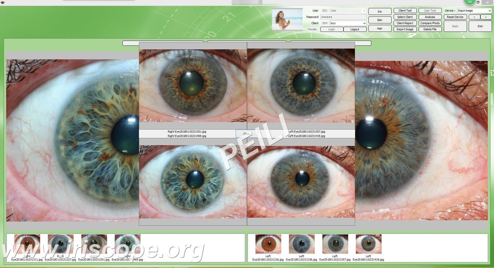 What reflexologists should know when searching for an iriscope in the UK — MAIKONG IRIDOLOGY CAMERA (47).JPG