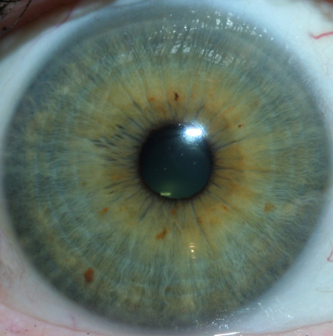 What reflexologists should know when searching for an iriscope in the UK — Portrait-of-Ignatz-von-Peczely-the-father-of-modern-iridology.jpeg