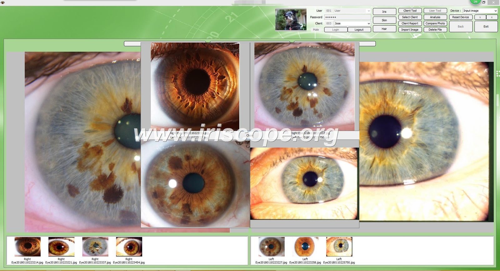 IrisLab‑style Iridology Equipment for Mobile Practitioners: What to expect from MAIKONG MK 980U and MK‑9822U — Software de Iridología (27).JPG