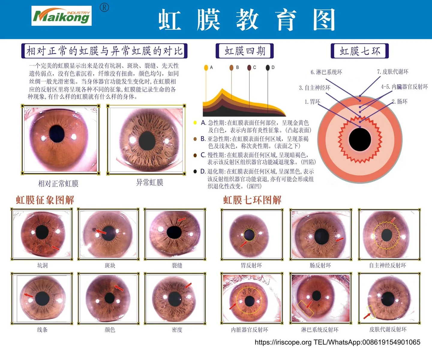 A4 Iridology Chart Transparency: what UK importers need to know before you buy — MAIKONG iridologia mapa (24).jpg