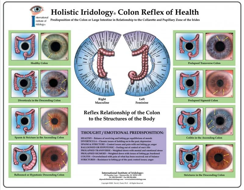 A4 Iridology Chart Transparency: what UK importers need to know before you buy — iridology images eye seasons spring eyes 4.jpg
