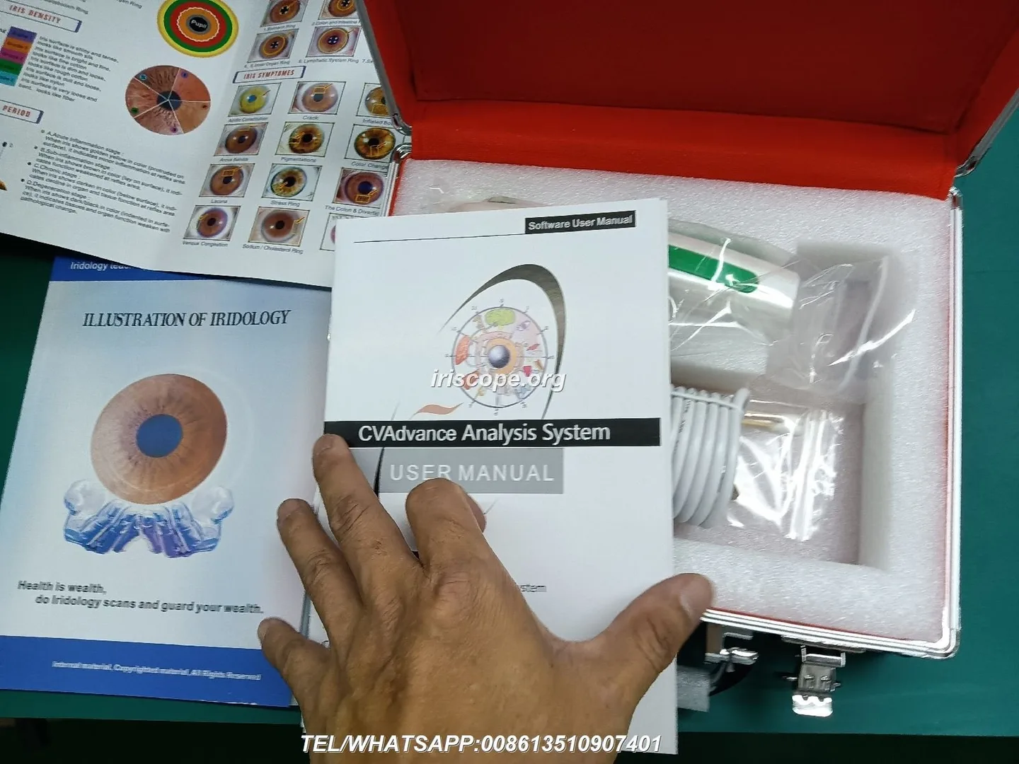 Advanced Iriscope I60 v5.1 — Practical guide for UK nutrition consultants — 00012.JPG