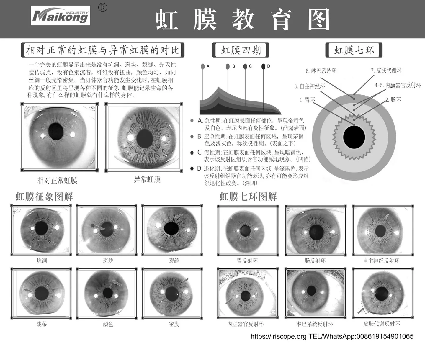 Advanced Iriscope I60 v5.1 — Practical guide for UK nutrition consultants — MAIKONG iridologia mapa (14).jpg