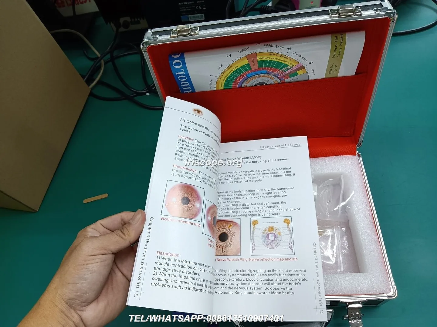 Advanced Iriscope I60 v5.1 — Practical guide for UK nutrition consultants — 00005.JPG