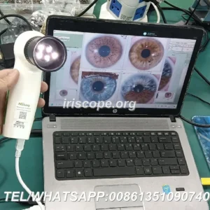 Advanced Iriscope I60 v5.1 — Practical guide for UK nutrition consultants — 094.JPG