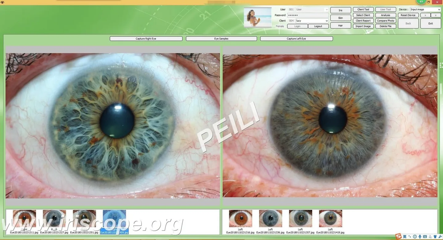 AI Iridology Guide for UK Wellness Exhibition Suppliers — how to run credible stand demos and what to tell visitors — MAIKONG IRIDOLOGY CAMERA (45).JPG