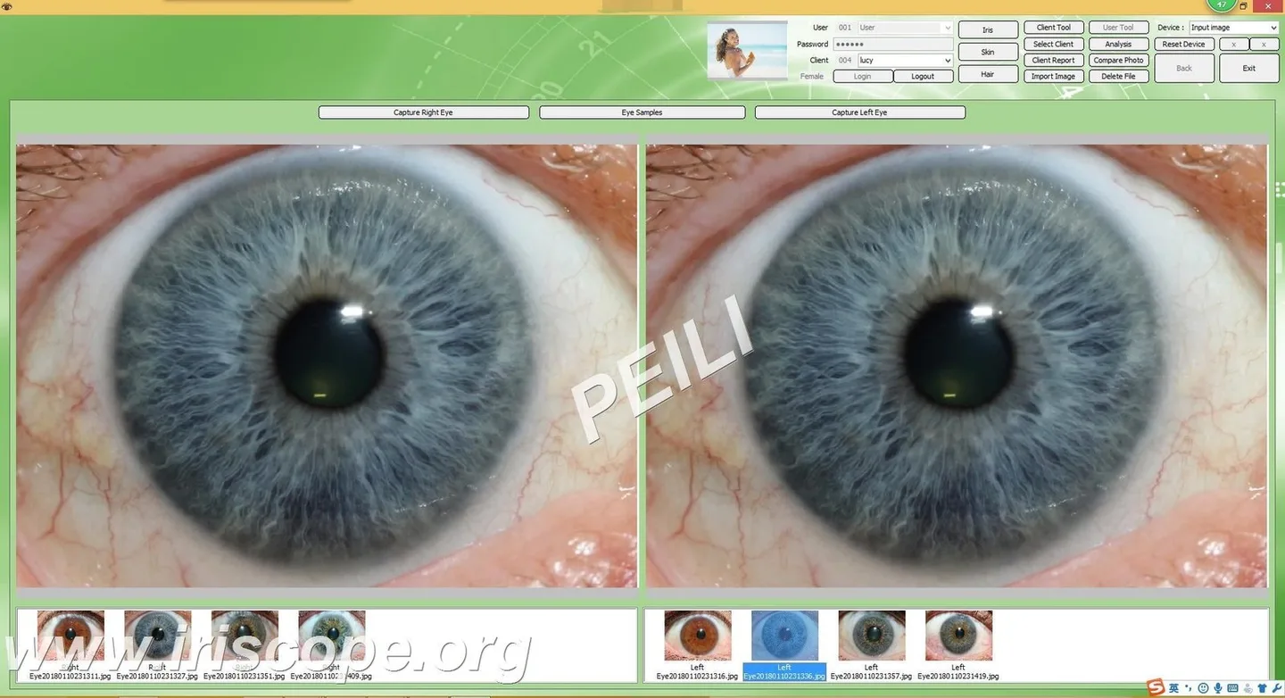 Best iridology manufacturers for UK natural health centres: a practical shortlist and how to choose — MAIKONG IRIDOLOGY CAMERA (43).JPG