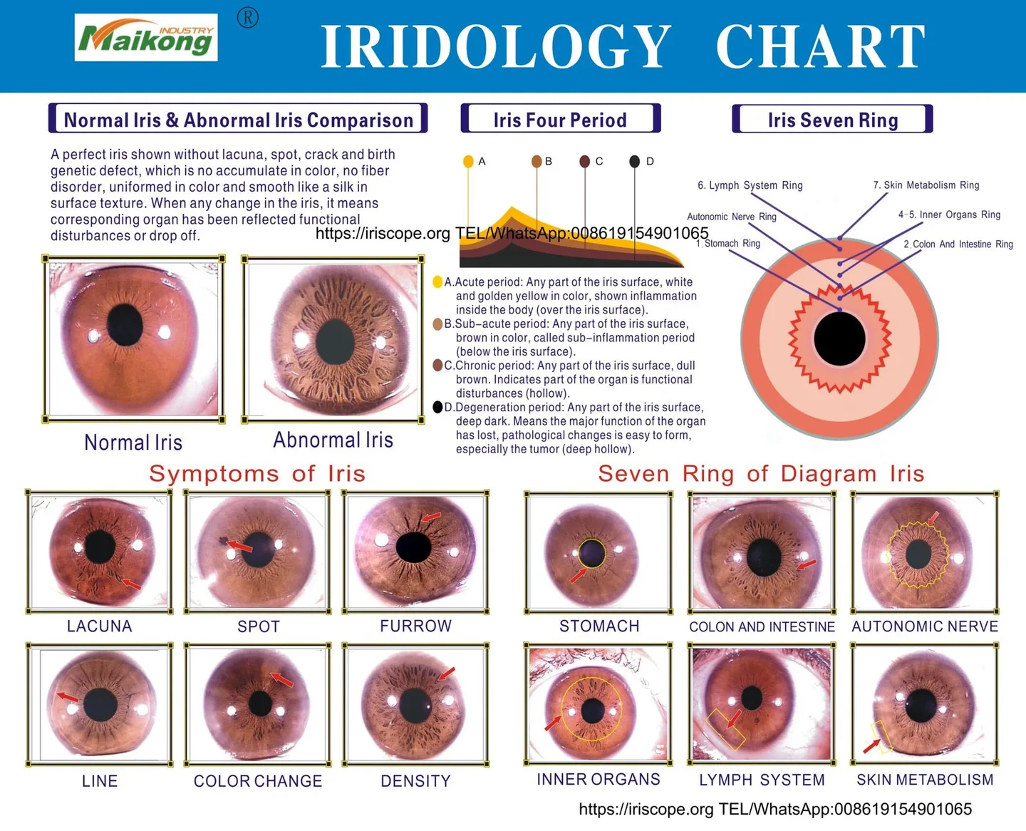 Iriscope iridology camera MK-12 — MAIKONG iridologia mapa (25).jpg