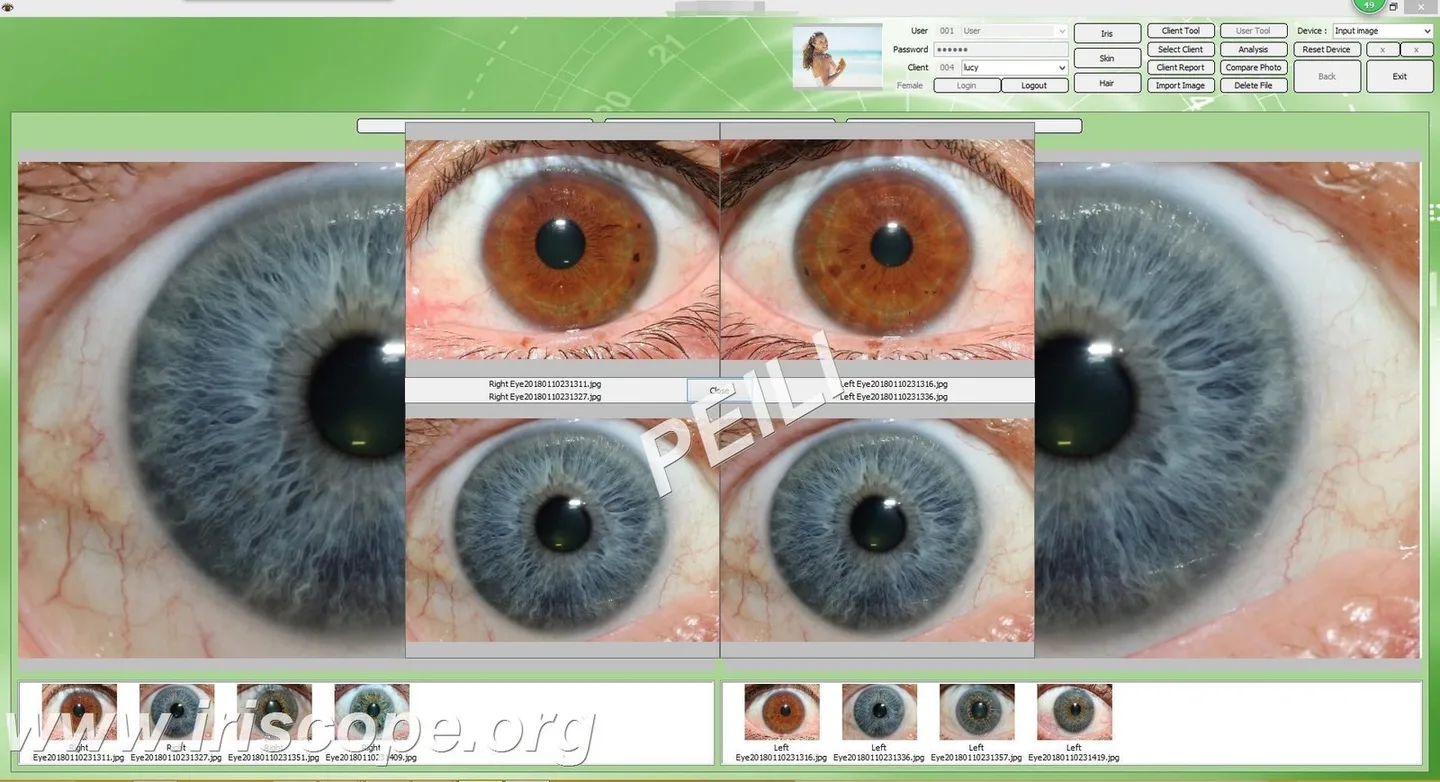 Best iridology manufacturers for UK natural health centres: a practical shortlist and how to choose — MAIKONG IRIDOLOGY CAMERA (46).JPG