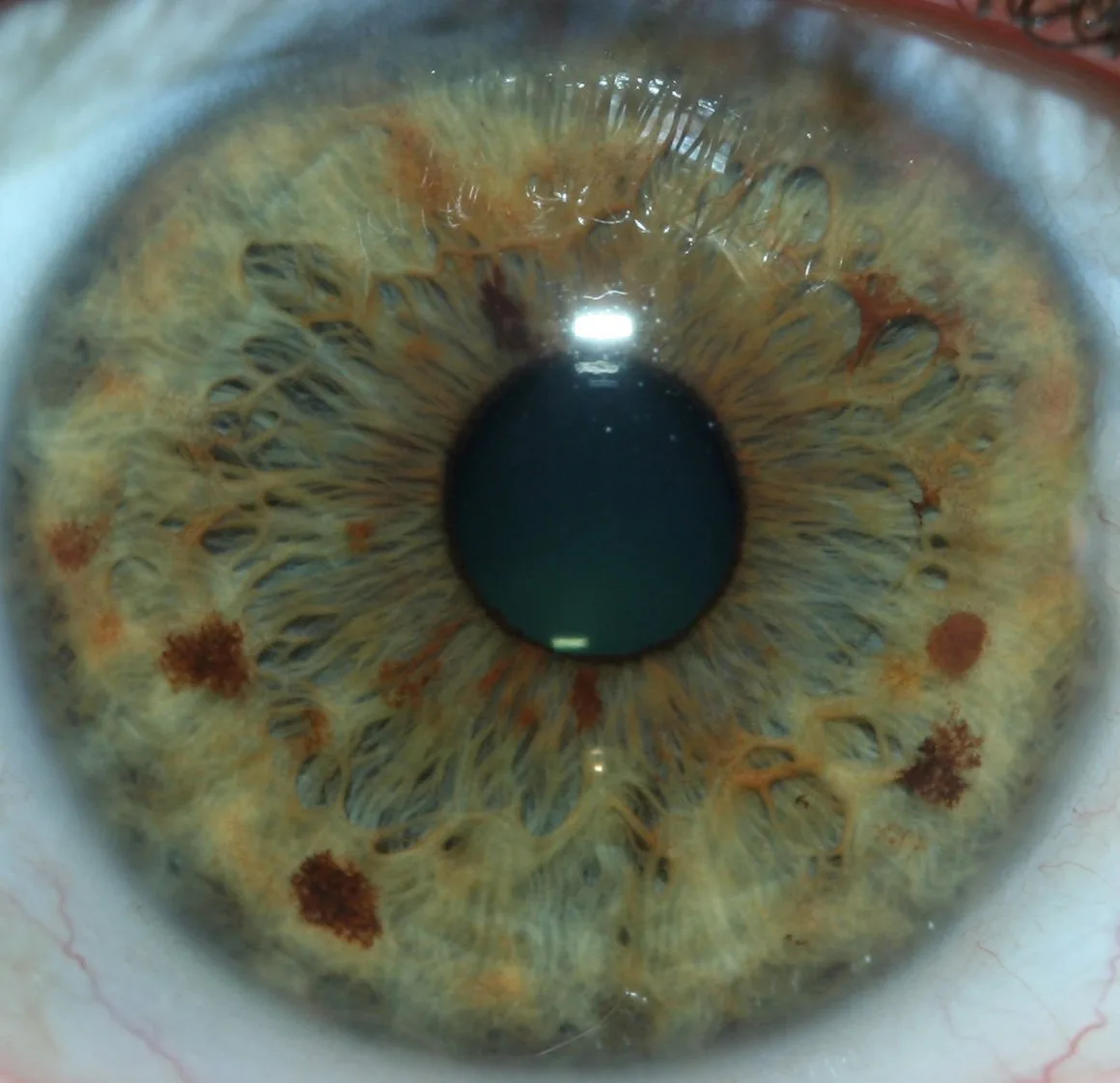 Best iridology manufacturers for UK natural health centres: a practical shortlist and how to choose — Global-map-showing-regions-where-iridology-is-most-popular-and-practiced-1024x585.jpeg