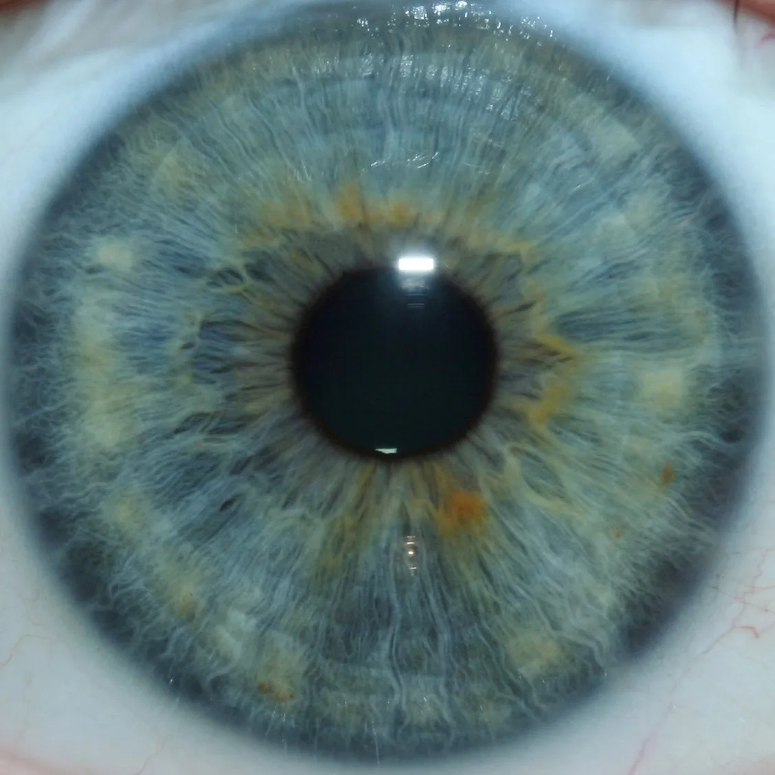 Best iridology manufacturers for UK natural health centres: a practical shortlist and how to choose — Global-map-showing-Maikong-iriscope-distribution-network-1024x585.jpeg