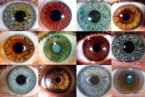 Black ring around the iris: practical guidance for UK holistic health practitioners — red ring around iris (23).jpg