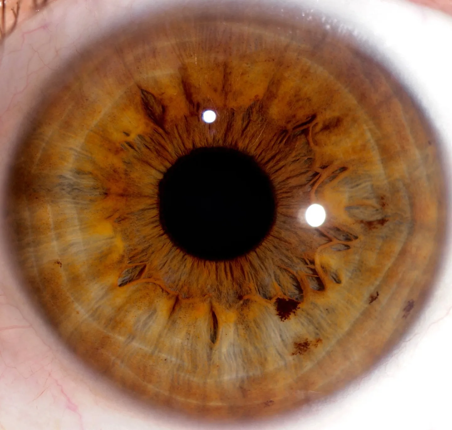 Integrated Iridology textbook — how to handle a slightly damaged copy for UK professional supply — Iridología (4).jpg