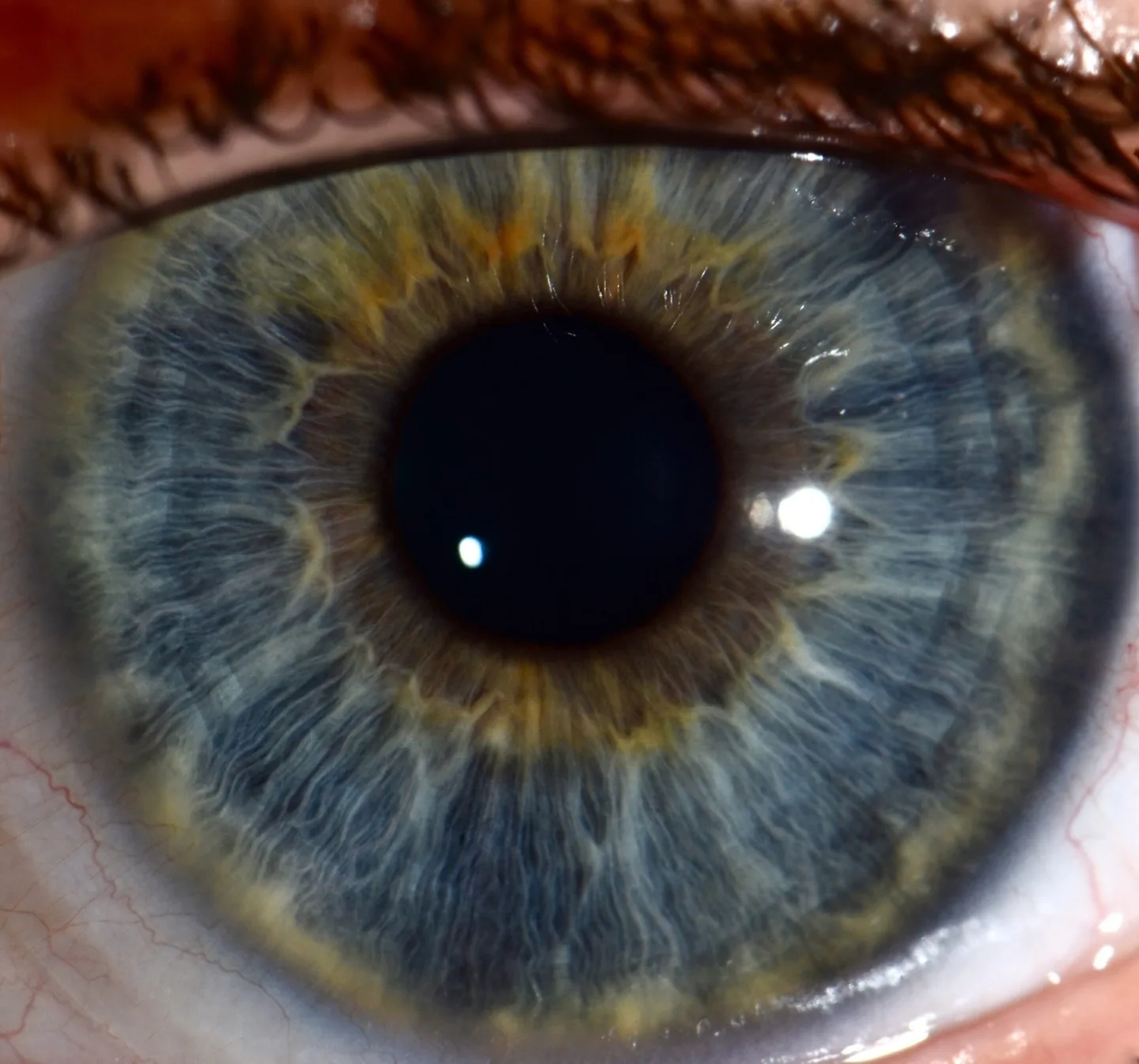 Integrated Iridology textbook — how to handle a slightly damaged copy for UK professional supply — Iridología (5).jpg