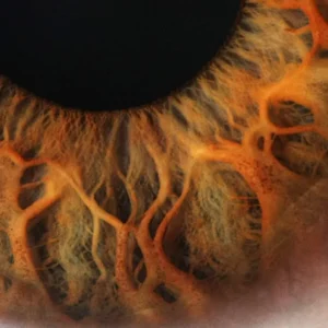 Integrated Iridology textbook — how to handle a slightly damaged copy for UK professional supply — Iridología (4).jpg