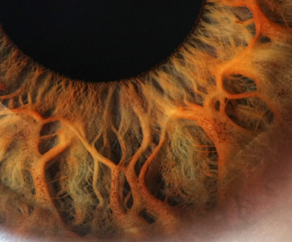 Integrated Iridology textbook — how to handle a slightly damaged copy for UK professional supply — Iridología (4).jpg