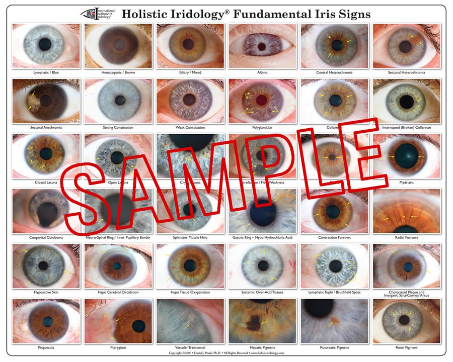 Iridology chart sample