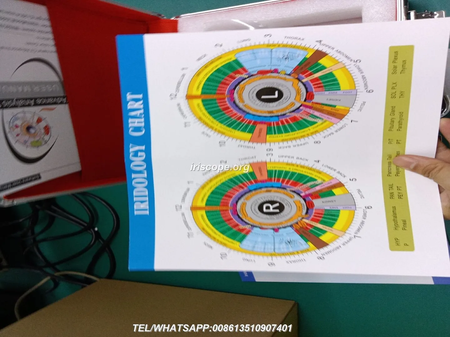 Practical guide to choosing an iridology cam for a UK holistic wellness centre — 00007.JPG