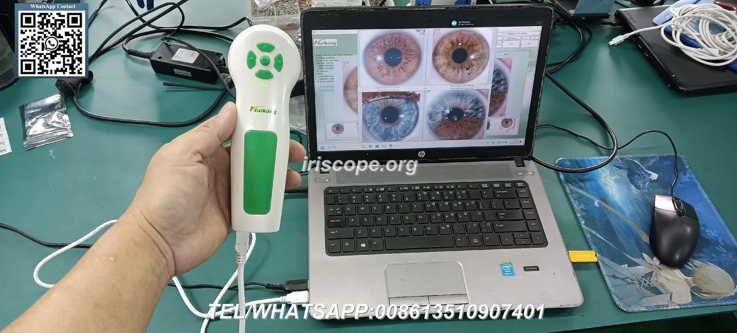 Practical guide to choosing an iridology cam for a UK holistic wellness centre — 081.JPG