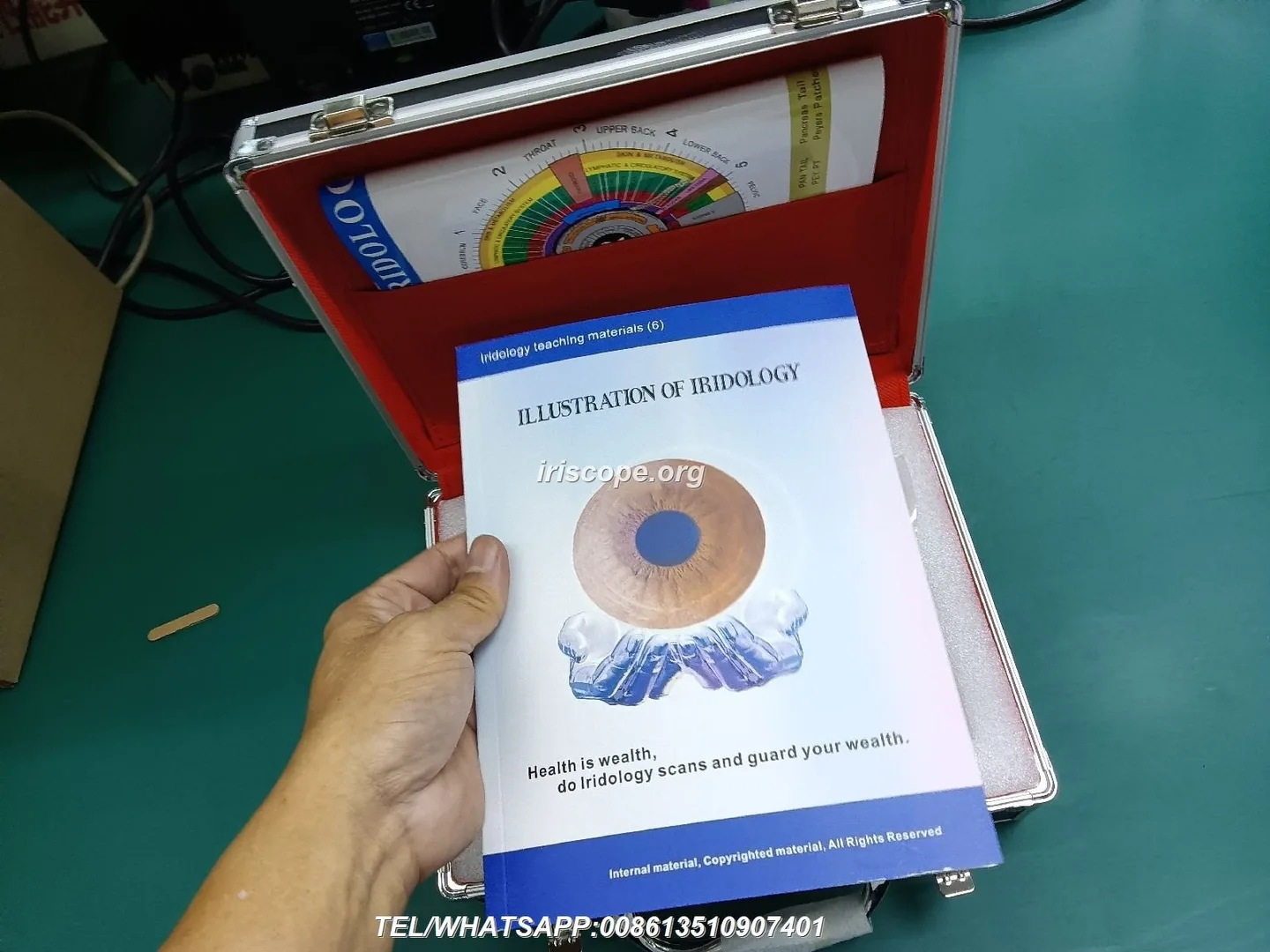 How to choose a reliable iridology camera supplier for a wholesale business in the UK — 00004.JPG