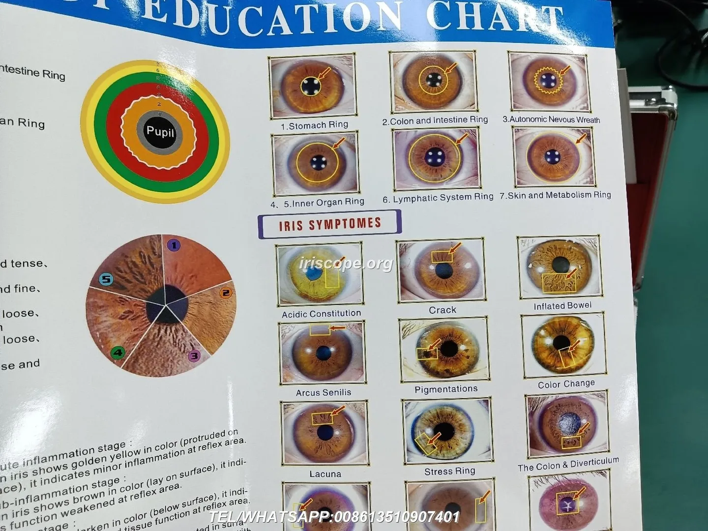 How to choose a reliable iridology camera supplier for a wholesale business in the UK — 00009.JPG