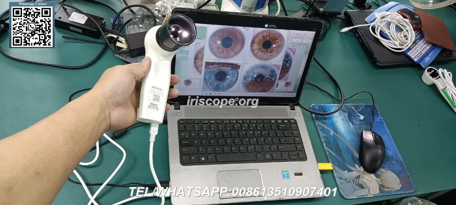 How to choose a reliable iridology camera supplier for a wholesale business in the UK — 092.JPG