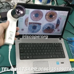 How to choose a reliable iridology camera supplier for a wholesale business in the UK — 092.JPG