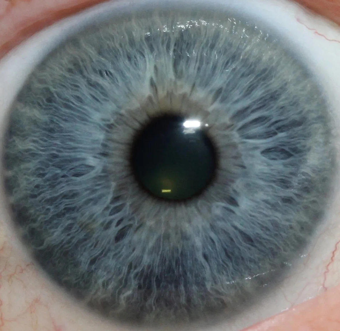 How Iris Analysis Fits into Your Biohacking Stack: Practical Guidance for UK Complementary Therapy Practitioners — 004-1.jpg