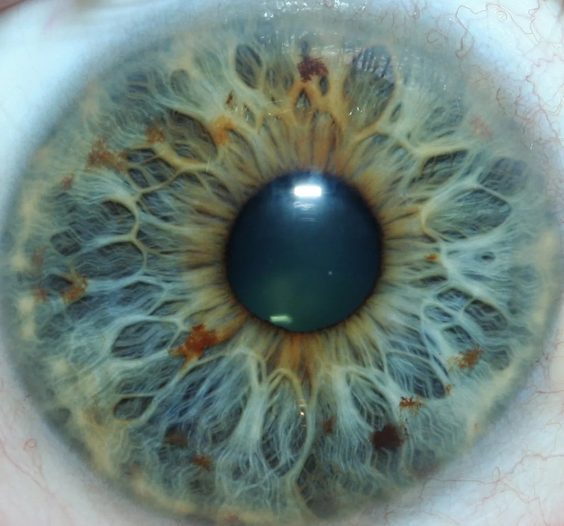 How Iris Analysis Fits into Your Biohacking Stack: Practical Guidance for UK Complementary Therapy Practitioners — httpsiriscope.orgwp-contentuploads202507Person-researching-iridology-information-on-computer-with-question-marks-overlay-1024x585.jpeg