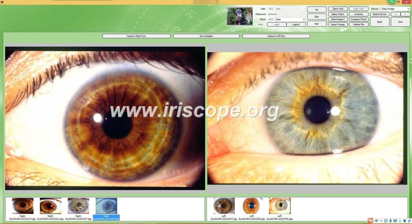 Iriscopes for UK wellness exhibitions: what suppliers need to know — Software de Iridología (14).JPG