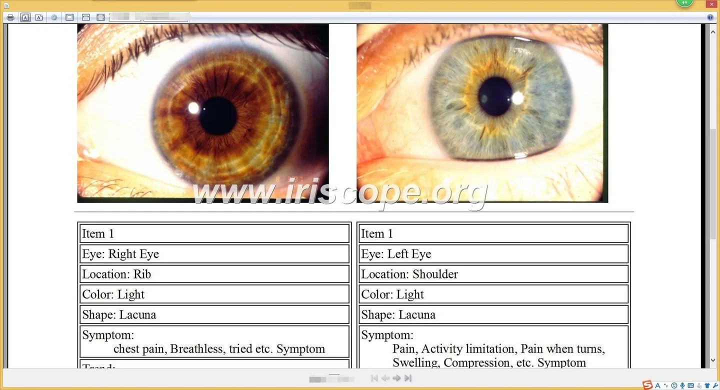 Iriscopes for UK wellness exhibitions: what suppliers need to know — Software de Iridología (25).JPG