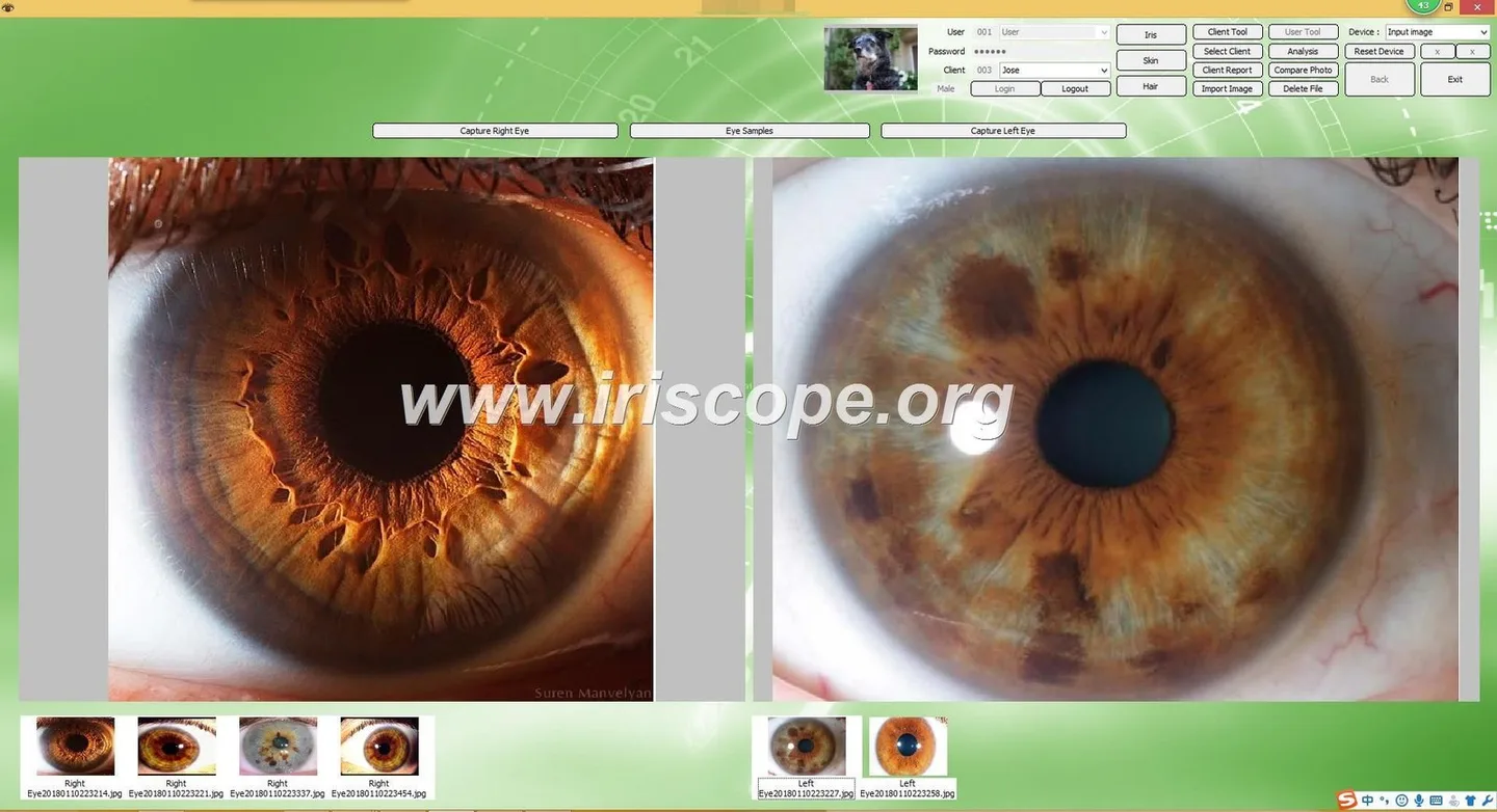 Practical guide for UK iridology course providers: is an iriscope iridology camera right for your training centre? — Software de Iridología (55).JPG