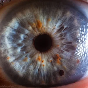 Master Iris Photography with the IrisExplorer G16: A Practical User’s Guide for UK Practitioners — Iridología (10).JPG