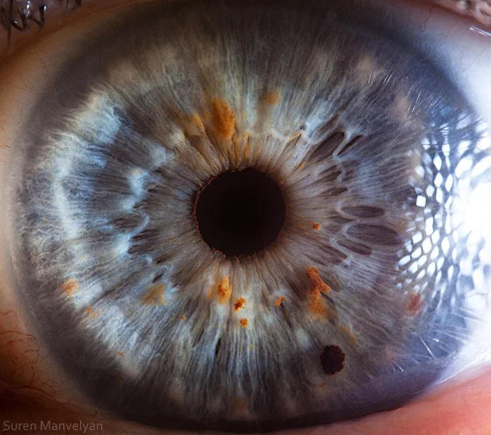 Master Iris Photography with the IrisExplorer G16: A Practical User’s Guide for UK Practitioners — Iridología (10).JPG