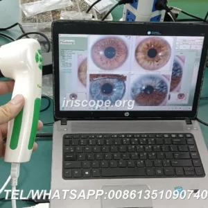IrisLab‑style Iridology Equipment for Mobile Practitioners: What to expect from MAIKONG MK 980U and MK‑9822U — 083.JPG