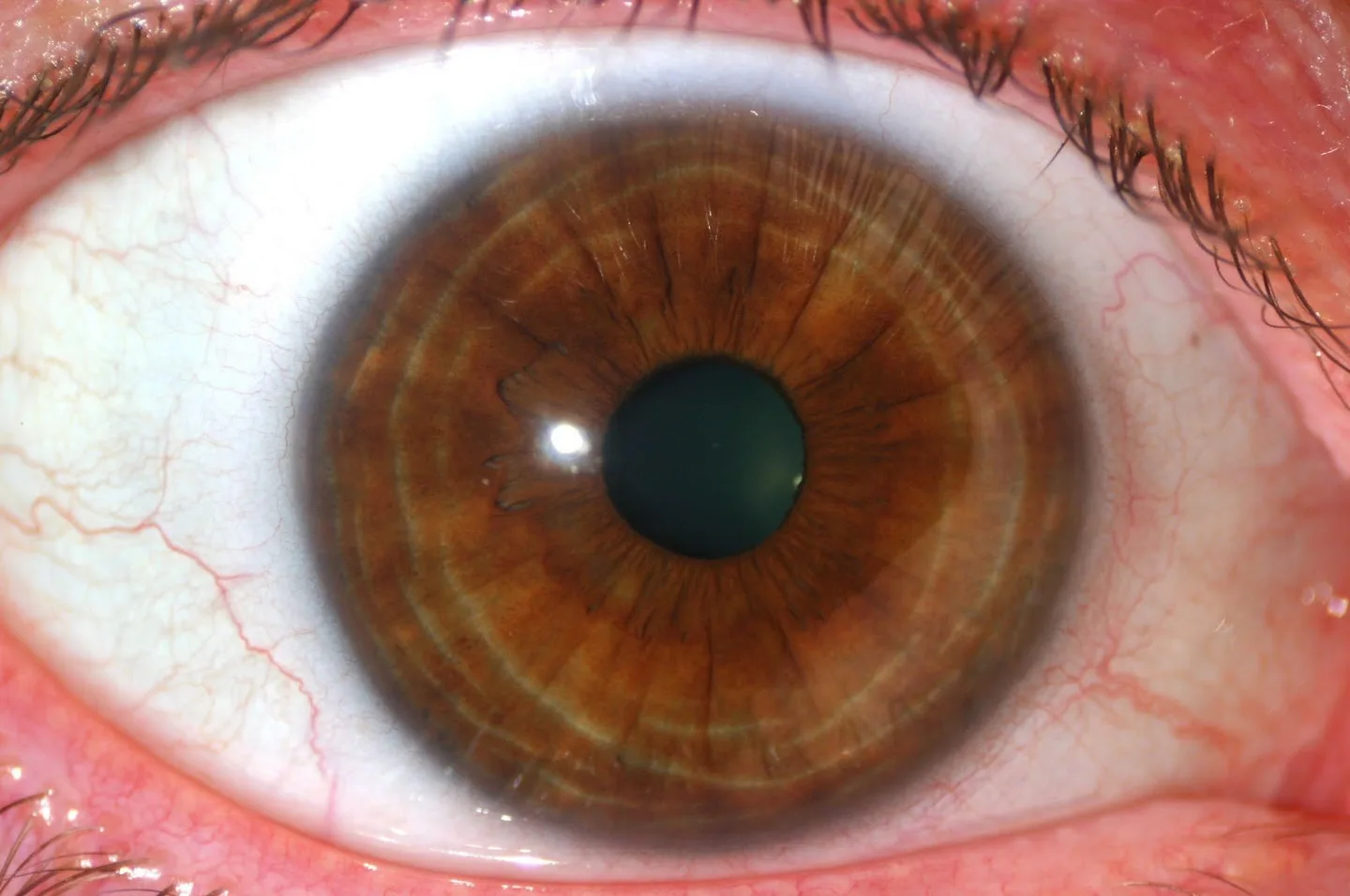 IrisLab: Leading‑Edge Iridology Cameras & Equipment — a practical guide for UK online wellness sellers — Iridología (2).jpg