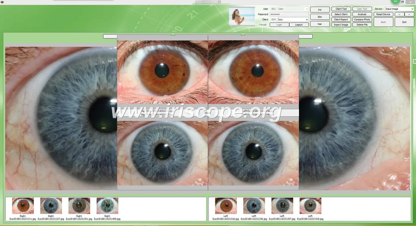 Who in the UK actually uses iriscope systems — a practical guide for holistic health educators — Software de Iridología (32).JPG