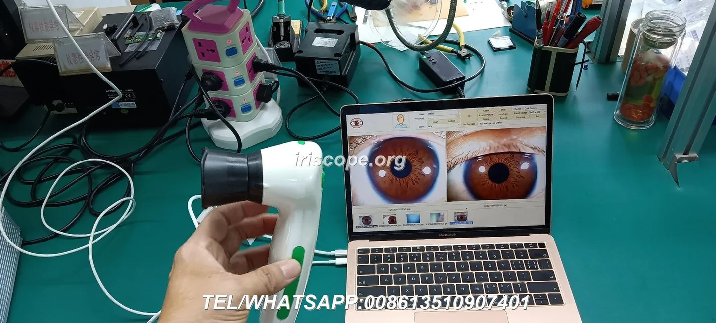 MAIKONG WIFI 20MP Iriscope camera MK 9888U — maikong iridology camera iriscope 12 mp for apple mac os (36).JPG