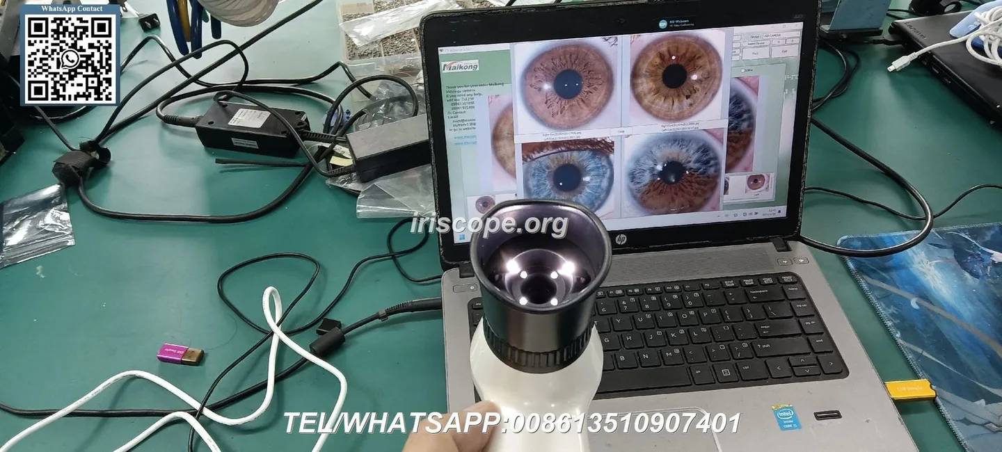 Who in the UK actually uses iriscope systems — a practical guide for holistic health educators — 087.JPG