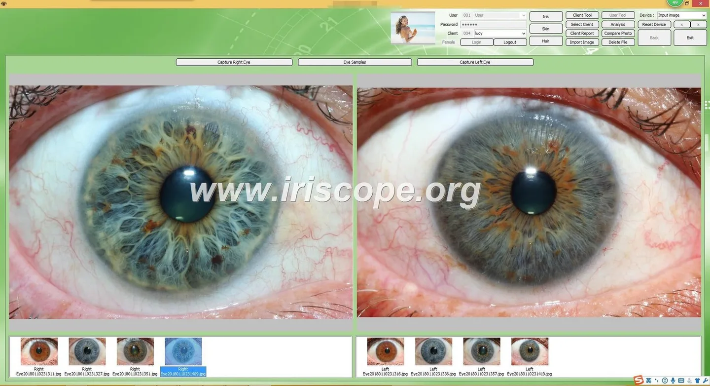 Who in the UK actually uses iriscope systems — a practical guide for holistic health educators — Software de Iridología (31).JPG